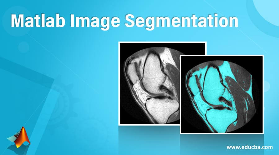 Matlab Image Segmentation